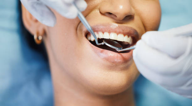 Best Emergency Dental Extractions in Kerrville, TX