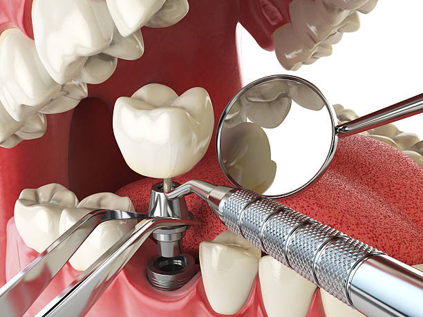 Best Emergency Dental Care for Abscessed Tooth in Kerrville, TX