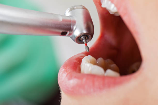 Best Emergency Dentist for Knocked-Out Tooth in Kerrville, TX